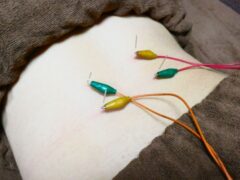 腰痛やぎっくり腰に対する鍼灸